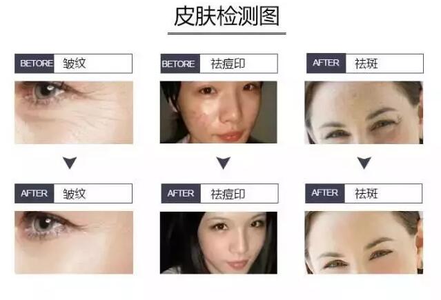 皮膚檢測